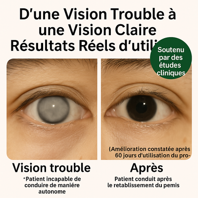Curavie™ Zoone – Vitamines Oculaires Premium à la Lutéine